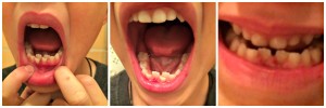 Tooth Fairy